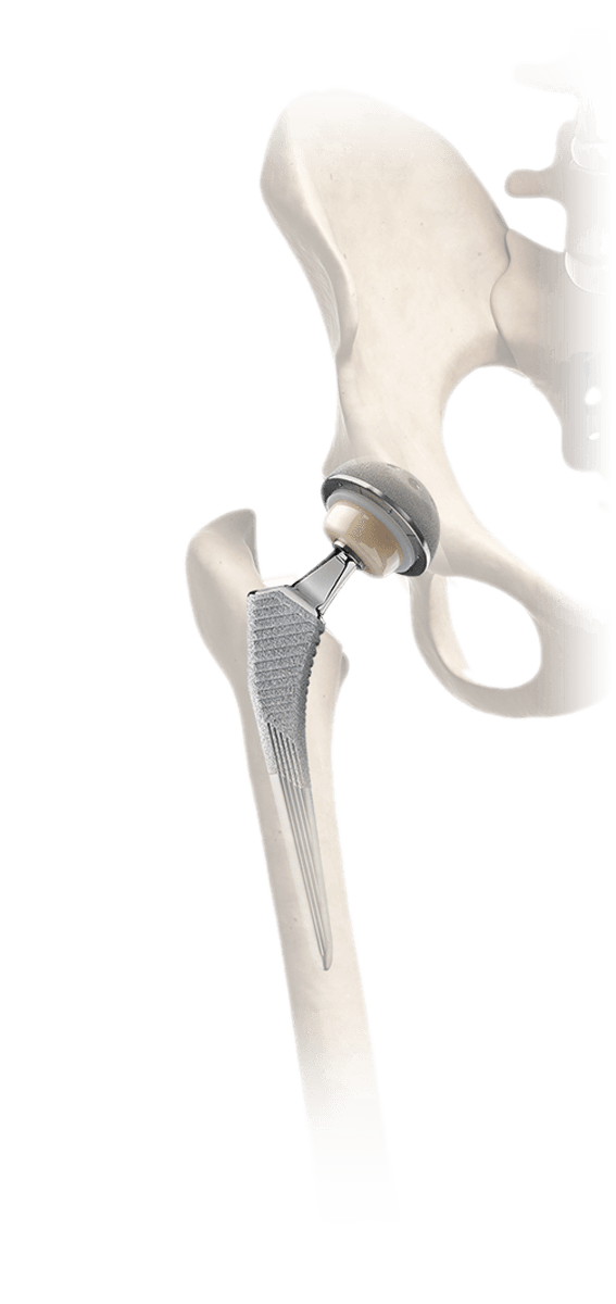 hip stem