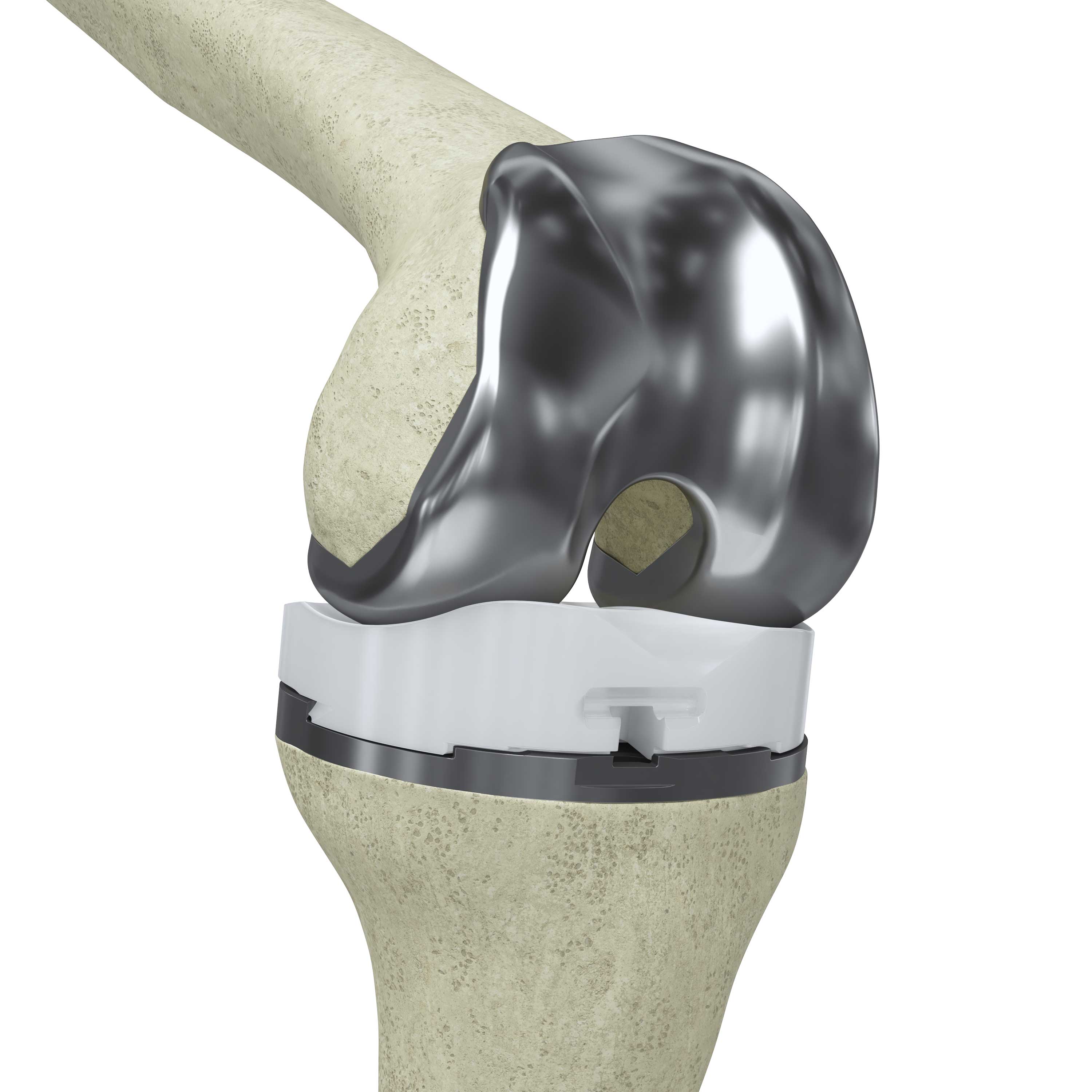 Evolution Medial-Pivot Knee