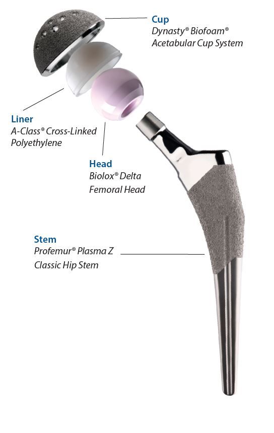 Understanding Total Hip Replacement Microport Orthopedics