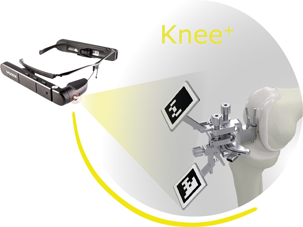 Knee
