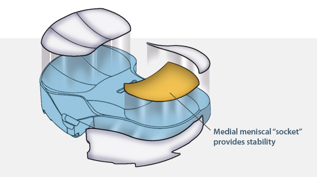 knee stability