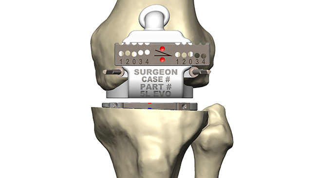 Prophecy® Gap Balancing System straight angle