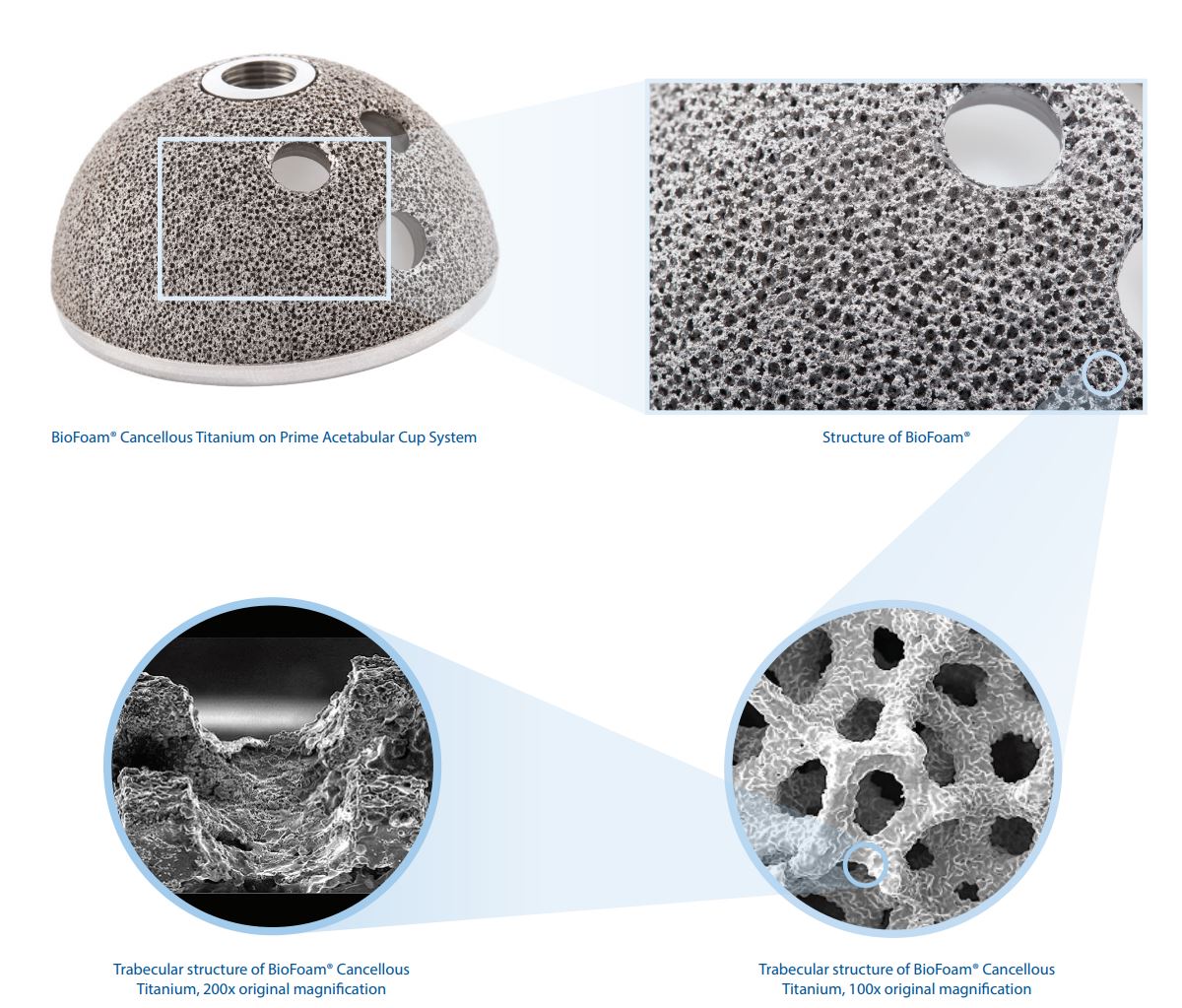 Biofoam magnification