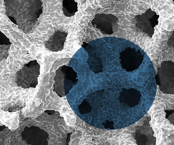 BioFoam® Cancellous Titanium Teaser